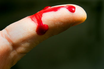 Dedo sangrando transmite HIV?