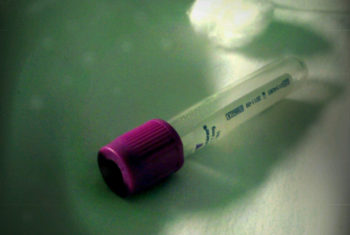 teste de HIV